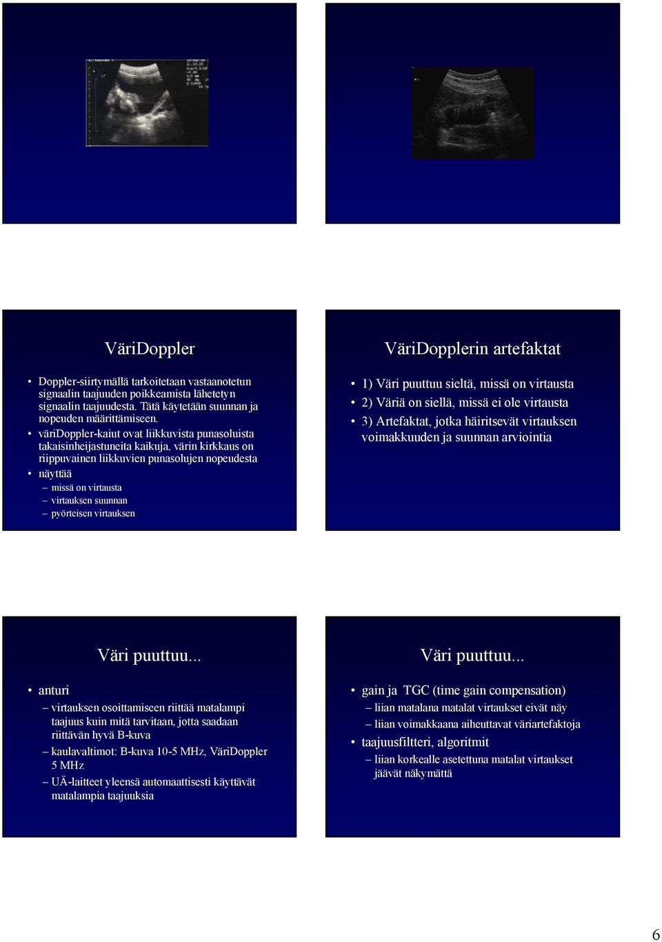 pyörteisen virtauksen VäriDopplerin artefaktat 1) Väri puuttuu sieltä, missä on virtausta 2) Väriä on siellä, missä ei ole virtausta 3) Artefaktat, jotka häiritsevät virtauksen voimakkuuden ja