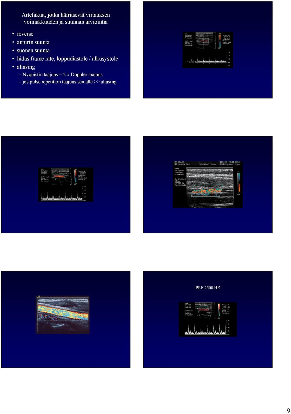 loppudiastole / alkusystole aliasing Nyquistin taajuus = 2 x