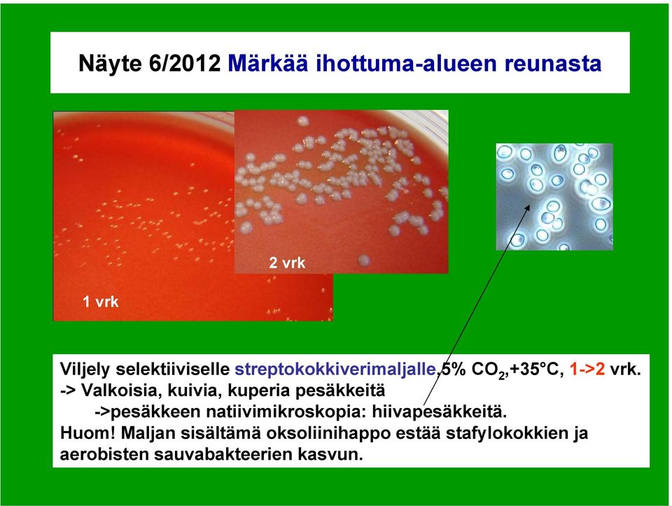 -> Valkoisia, kuivia, kuperia pesäkkeitä ->pesäkkeen natiivimikroskopia: