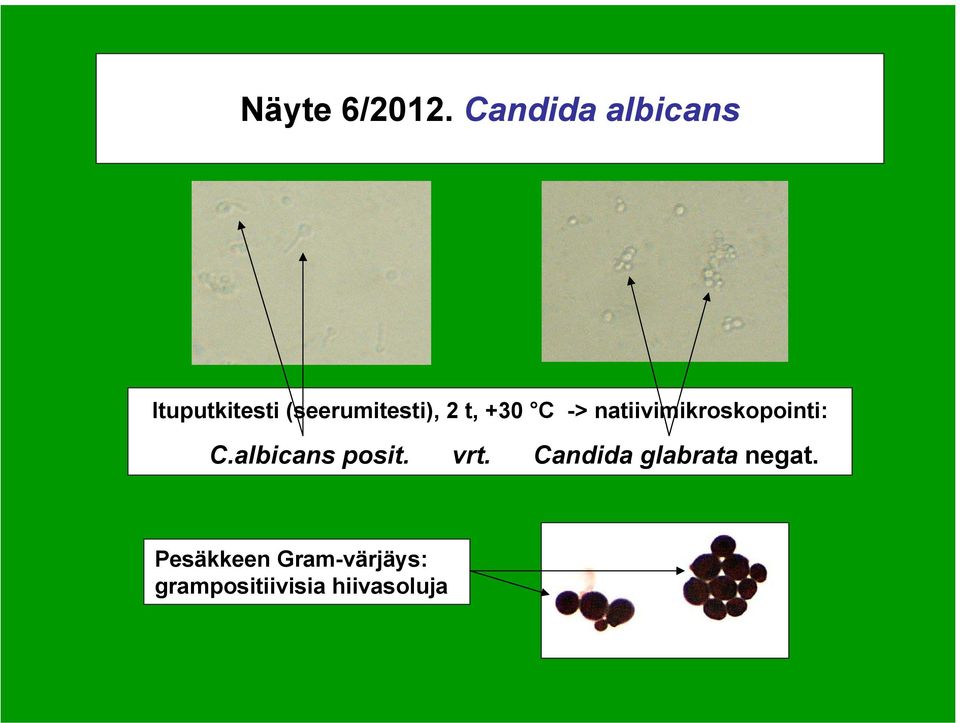 t, +30 C -> natiivimikroskopointi: C.