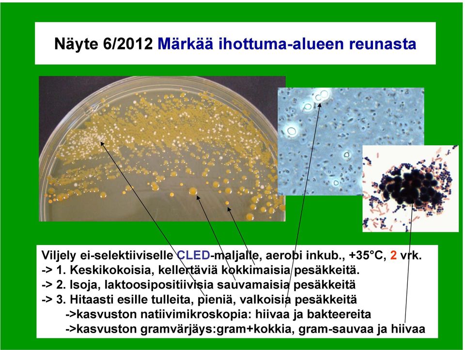 Isoja, laktoosipositiivisia sauvamaisia pesäkkeitä -> 3.