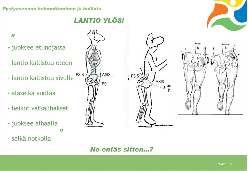 kallistuu sivulle - alaselkä vuotaa - heikot