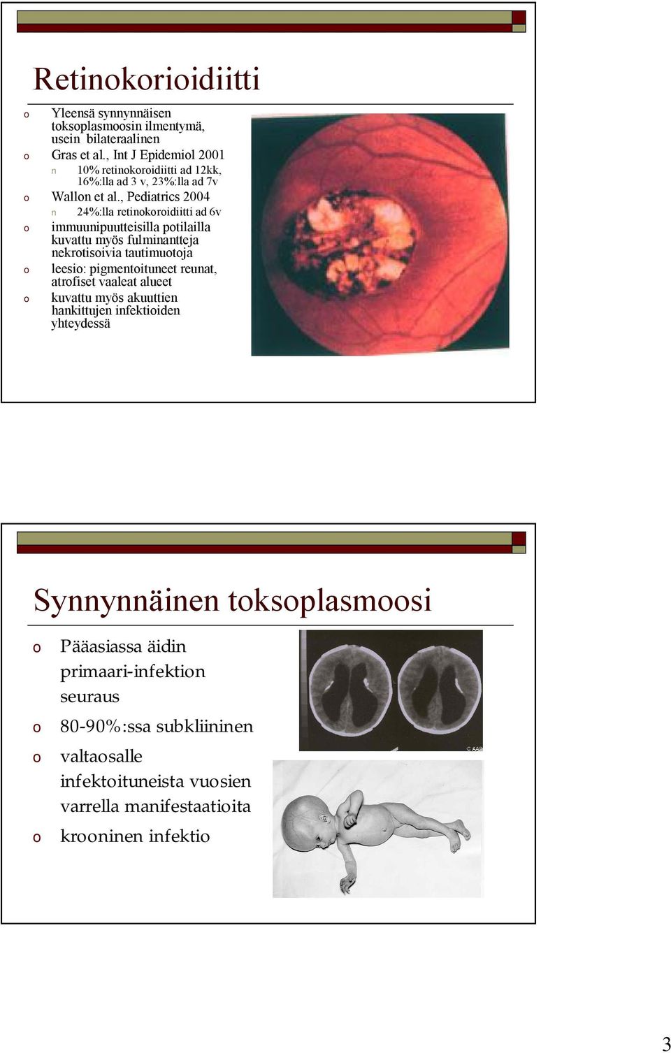 , Pediatrics 2004 24%:lla retinokoroidiitti ad 6v o immuunipuutteisilla potilailla kuvattu myös fulminantteja nekrotisoivia tautimuotoja o leesio: