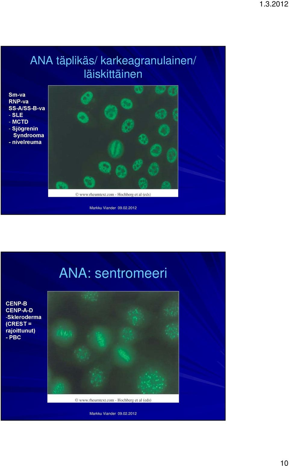Sjögrenin Syndrooma -nivelreuma ANA: sentromeeri