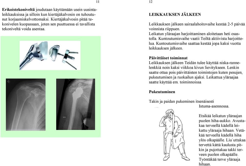 11 12 LEIKKAUKSEN JÄLKEEN Leikkauksen jälkeen sairaalahoitovaihe kestää 2-5 päivää voinnista riippuen. Leikatun yläraajan harjoittaminen aloitetaan heti osastolla.