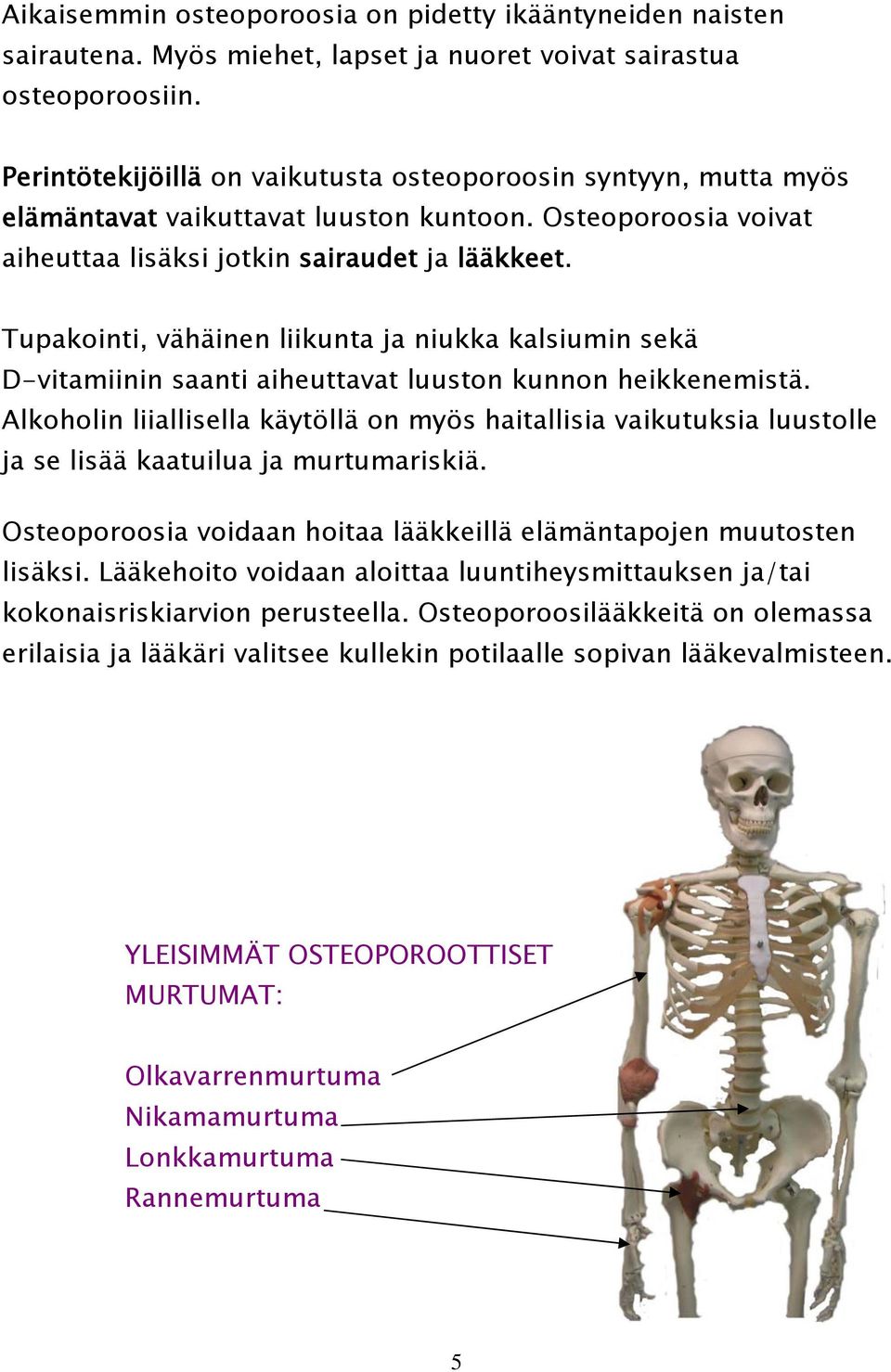 Tupakointi, vähäinen liikunta ja niukka kalsiumin sekä D-vitamiinin saanti aiheuttavat luuston kunnon heikkenemistä.