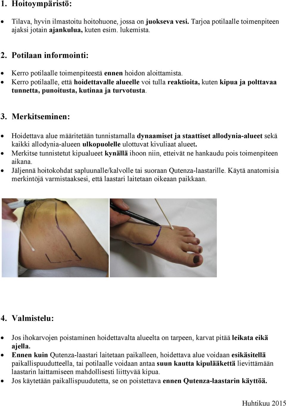 Kerro potilaalle, että hoidettavalle alueelle voi tulla reaktioita, kuten kipua ja polttavaa tunnetta, punoitusta, kutinaa ja turvotusta. 3.