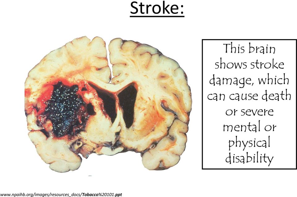 severe mental or physical disability