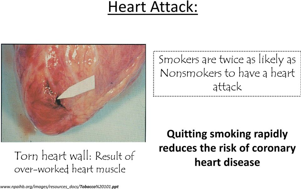 muscle Quitting smoking rapidly reduces the risk of coronary