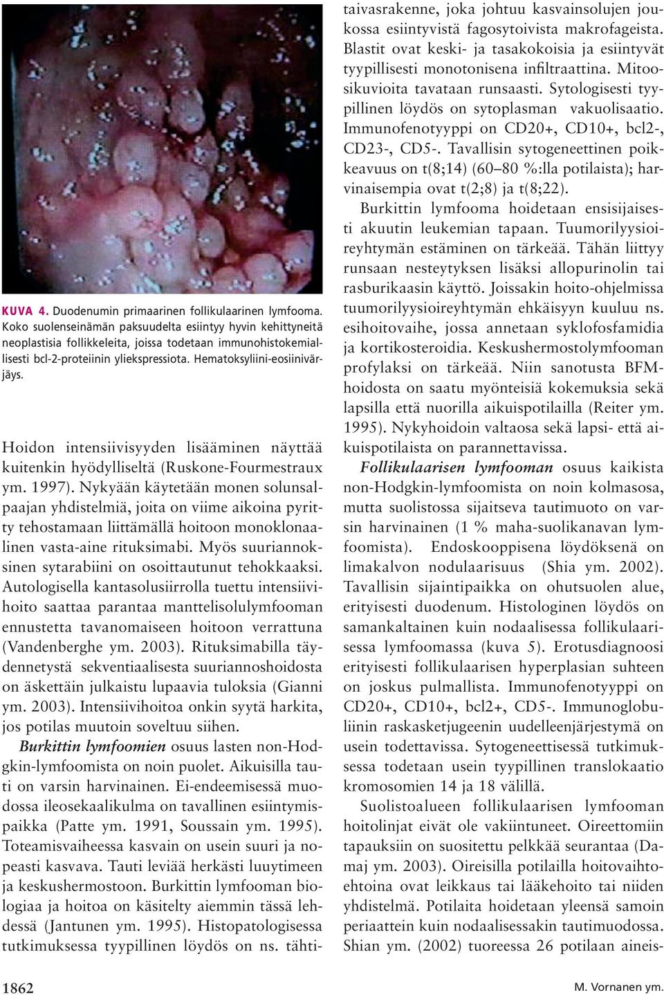 Hoidon intensiivisyyden lisääminen näyttää kuitenkin hyödylliseltä (Ruskone-Fourmestraux ym. 1997).