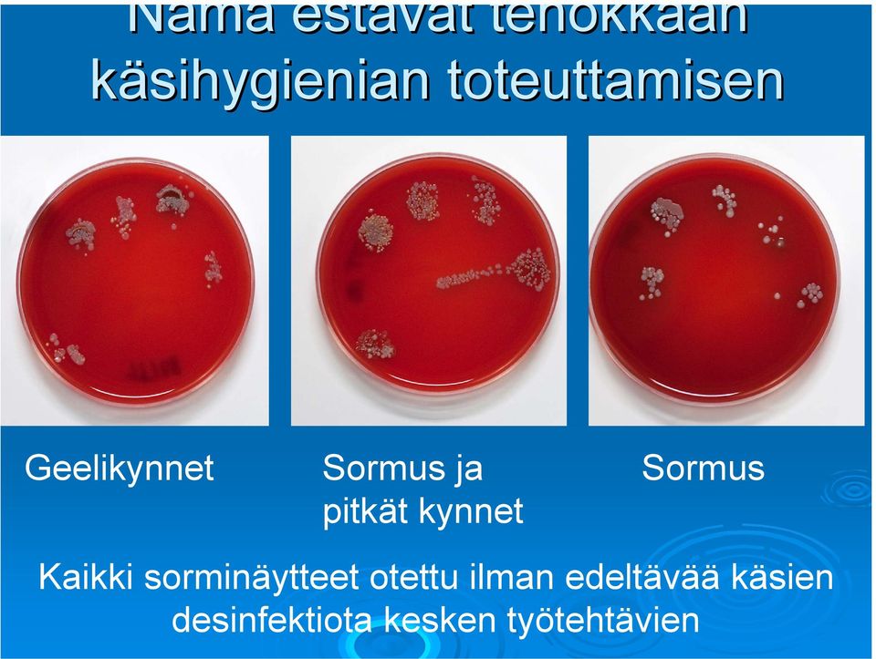 kynnet Sormus Kaikki sorminäytteet otettu