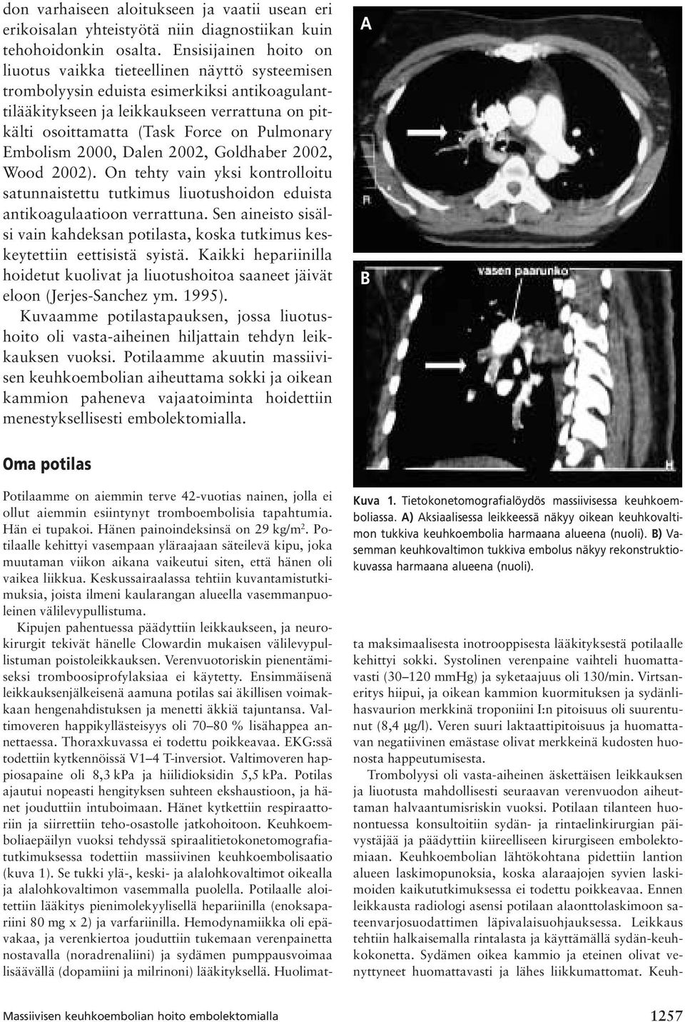 Pulmonary Embolism 2000, Dalen 2002, Goldhaber 2002, Wood 2002). On tehty vain yksi kontrolloitu satunnaistettu tutkimus liuotushoidon eduista antikoagulaatioon verrattuna.