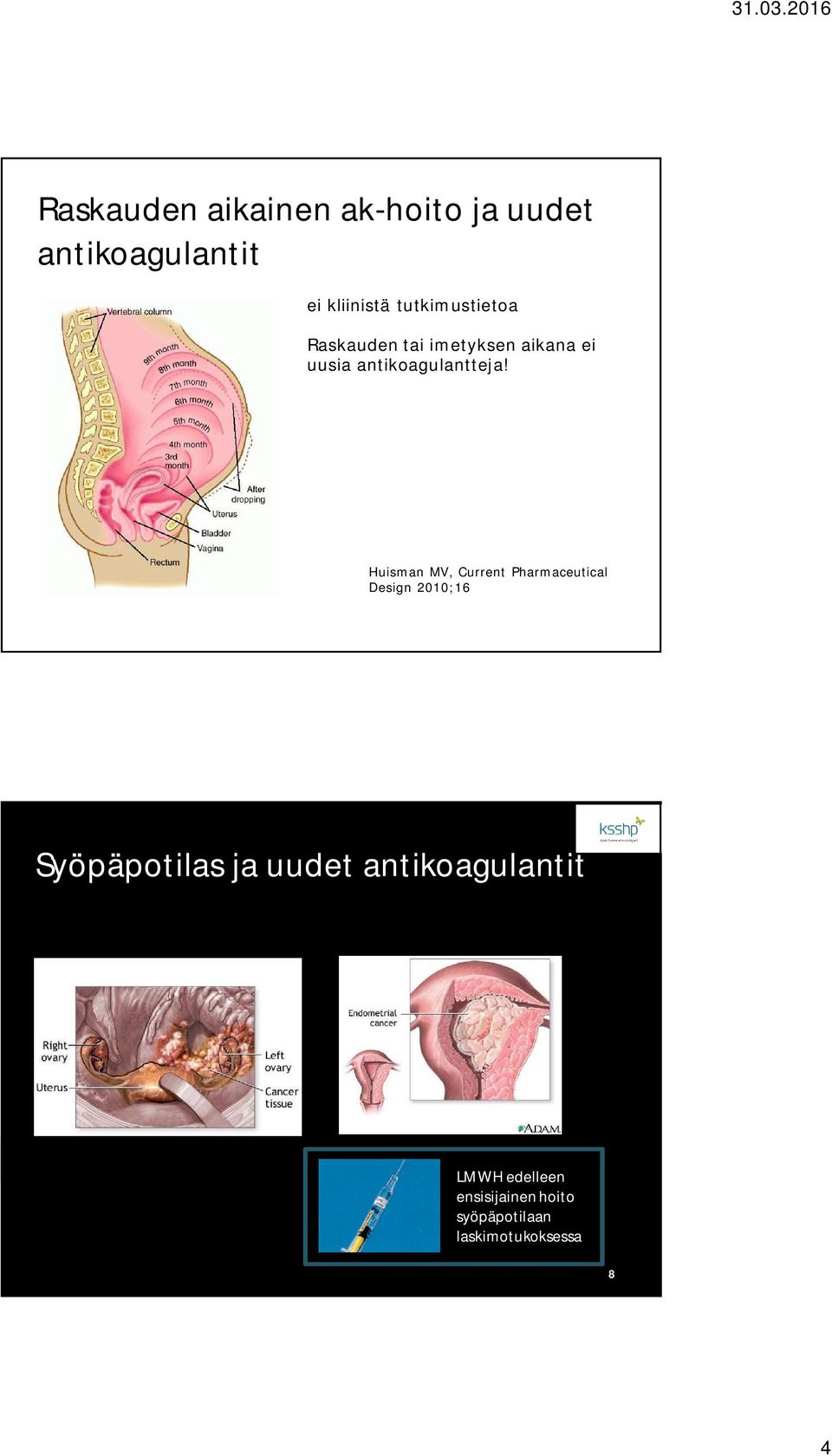 Huisman MV, Current Pharmaceutical Design 2010;16 7 Syöpäpotilas ja uudet