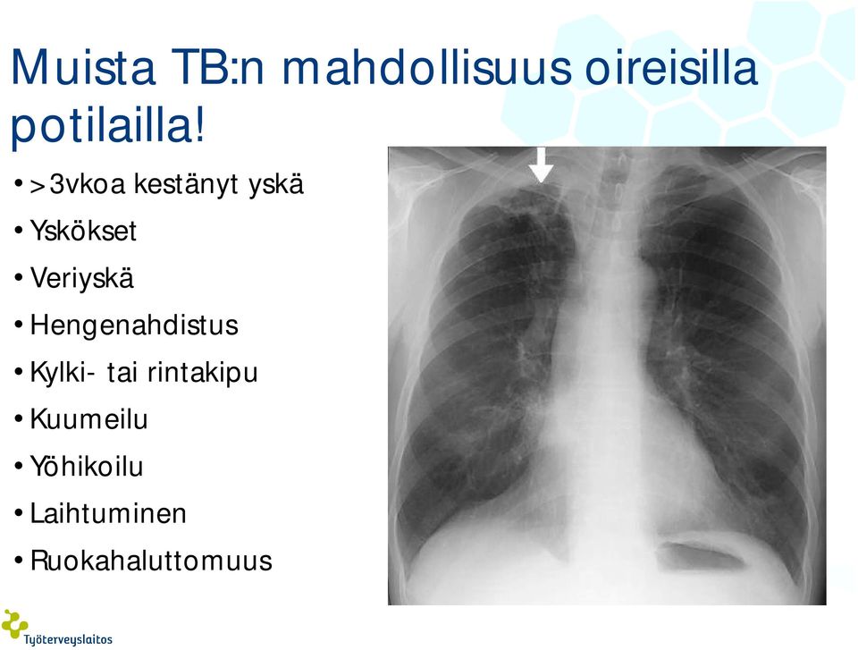 >3vkoa kestänyt yskä Yskökset Veriyskä