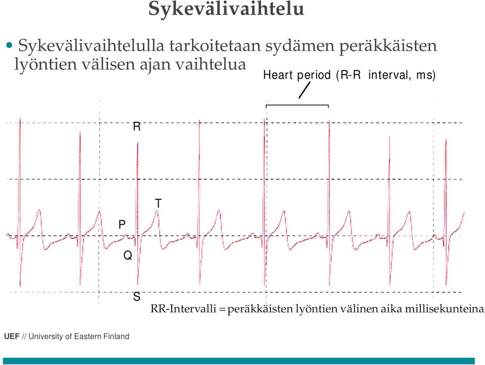 Heart period (R-R interval, ms) R P T Q S