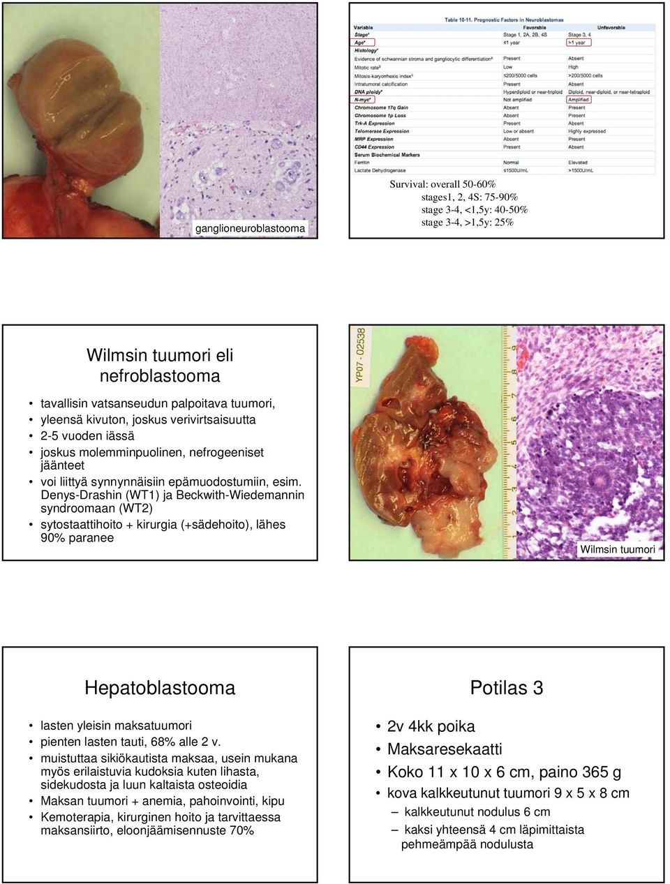 Denys-Drashin (WT1) ja Beckwith-Wiedemannin syndroomaan (WT2) sytostaattihoito + kirurgia (+sädehoito), lähes 90% paranee Wilmsin tuumori Hepatoblastooma lasten yleisin maksatuumori pienten lasten