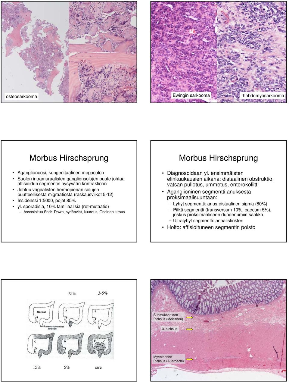 Down, sydänviat, kuurous, Ondinen kirous Morbus Hirschsprung Diagnosoidaan yl.