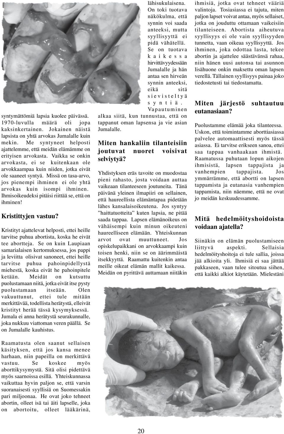 Missä on tasa-arvo, jos pienempi ihminen ei ole yhtä arvokas kuin isompi ihminen. Ihmisoikeudeksi pitäisi riittää se, että on ihminen! Kristittyjen vastuu?