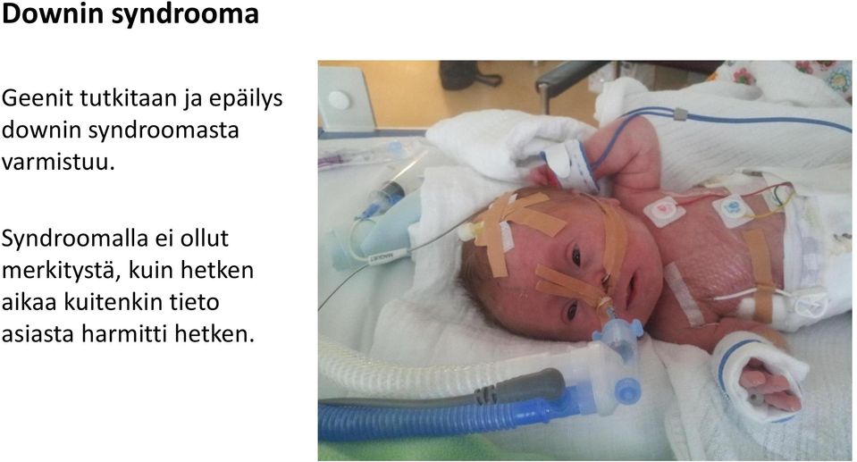 Syndroomalla ei ollut merkitystä, kuin