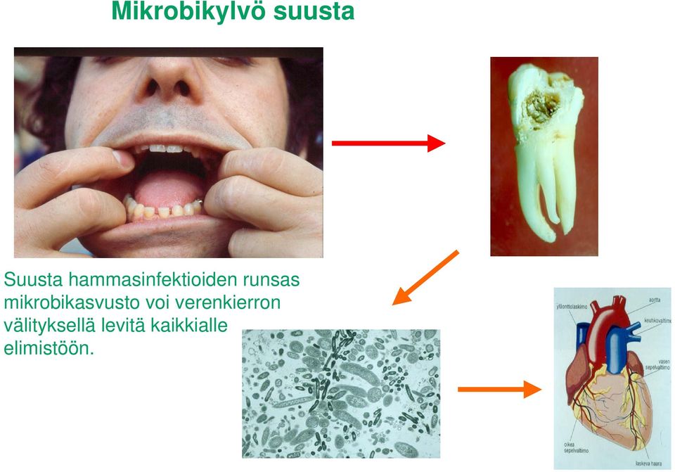 mikrobikasvusto voi