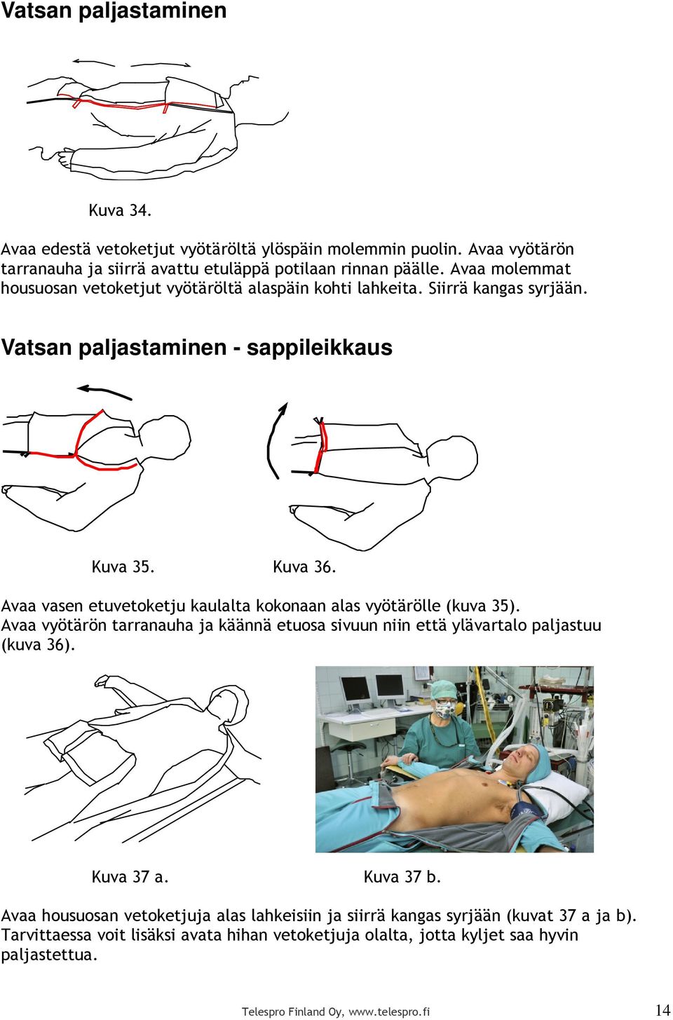 Avaa vasen etuvetoketju kaulalta kokonaan alas vyötärölle (kuva 35). Avaa vyötärön tarranauha ja käännä etuosa sivuun niin että ylävartalo paljastuu (kuva 36). Kuva 37 a.