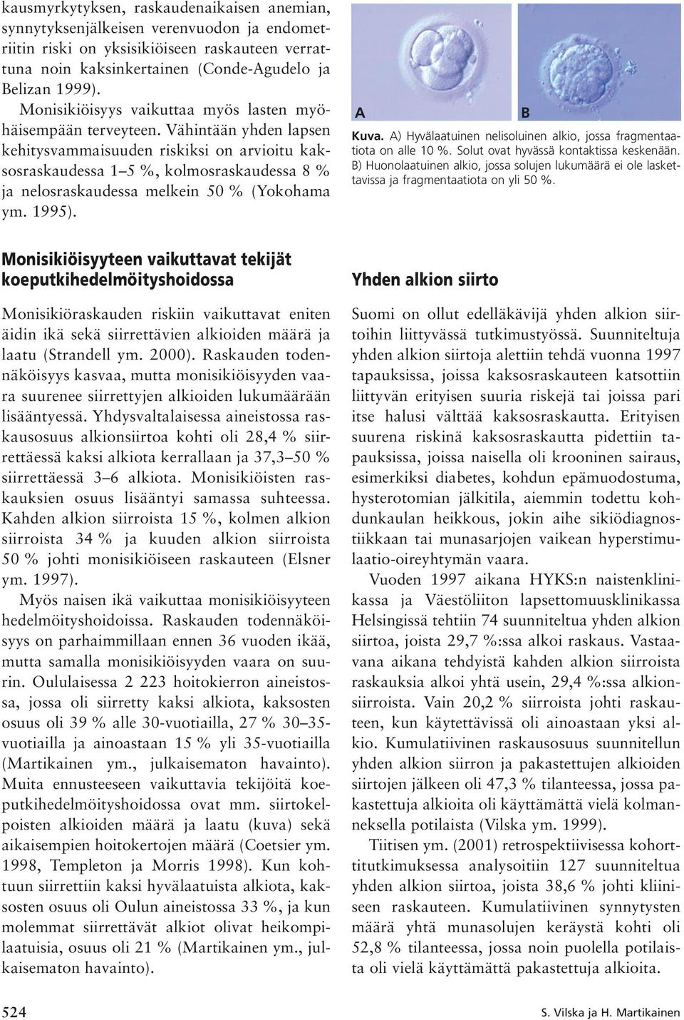 Vähintään yhden lapsen kehitysvammaisuuden riskiksi on arvioitu kaksosraskaudessa 1 5 %, kolmosraskaudessa 8 % ja nelosraskaudessa melkein 50 % (Yokohama ym. 1995). A B Kuva.