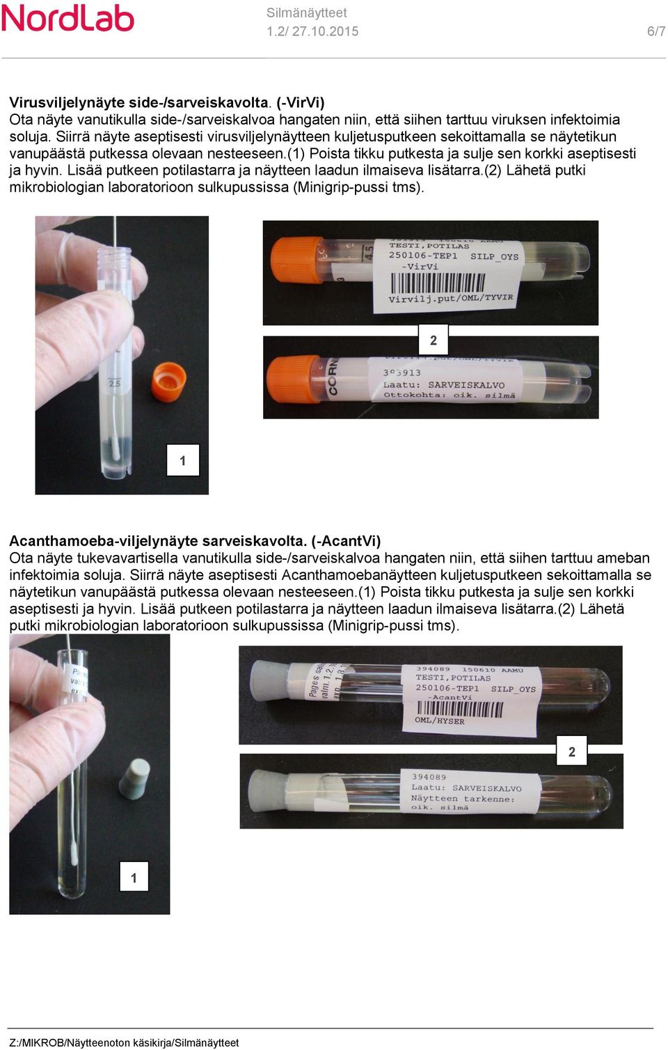 Lisää putkeen potilastarra ja näytteen laadun ilmaiseva lisätarra.() Lähetä putki mikrobiologian laboratorioon sulkupussissa (Minigrip-pussi tms). Acanthamoeba-viljelynäyte sarveiskavolta.