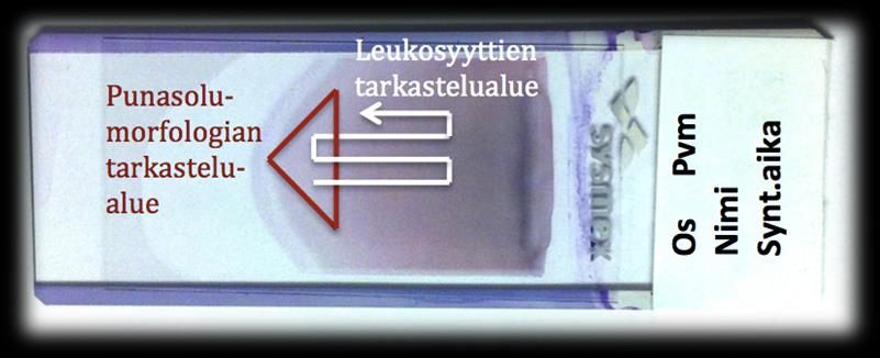 25 teellisin tarkastelualue on suunnilleen sivelyvalmisteen keskellä oleva ohuempi alue (Siitonen 2012, 158).