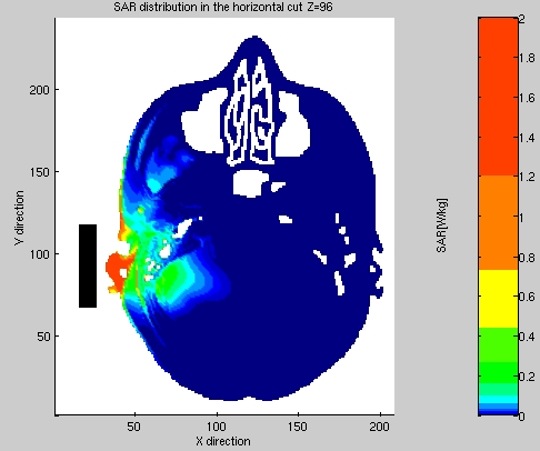 Matkapuhelimen aiheuttama SAR-jakauma päässä Matkapuhelimen aiheuttama SAR on pinnallinen, koska pää on puhelimen