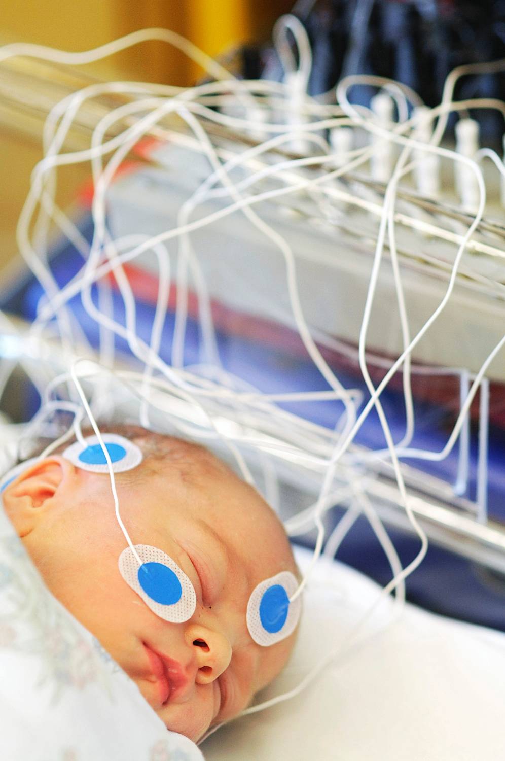 ERP and EEG Measured in infants during sleep The babies brains are far more