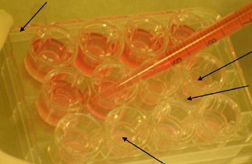 44 Kulkeutumiskokeita varten solut siirrostettiin 12-kuoppalevyn (Traswell, 3401) polykarbonaattifilttereille solutiheydellä 6,8 x 10 4 solua /cm 2.