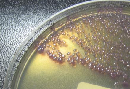 8 lähinnä haluttuja Enterobacteriaceae-heimon resistenttejä kantoja. (Paterson Bonomo 2005.) Kuviossa 1 on esitetty ESBL E. coli -bakteerin kasvu eräällä selektiivisellä kromogeenisella maljalla.