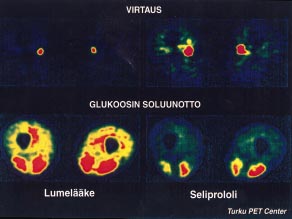 vaikutusten laadusta, laajuudesta, kestosta ym. voidaan toisaalta saada tietoa erityyppisten toiminnallisten kuvantamistutkimusten avulla.