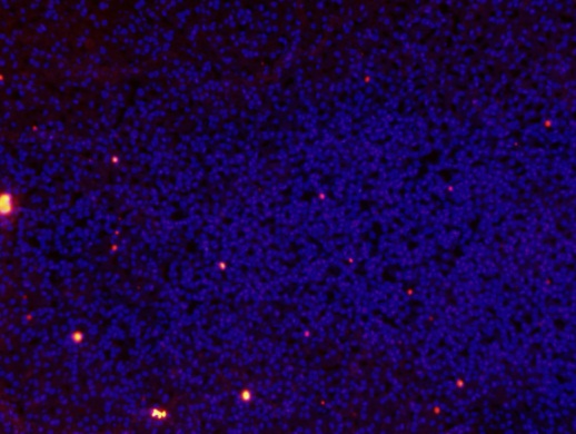 34 A B C D Kuva 5. Fluoresenssivärjäyksellä saadut tulokset. Fluoresenssivärjäys tehtiin hiiren lisämunuaisleikkeille käyttäen Covancen HA.