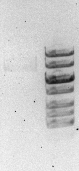pssh MW 10000 bp 8000 bp 6000 bp KUVA 14. Testiajon agaroosigeeli DNA:n puhdistumista testattiin taas testiligaatiolla ja transformaatiolla, mutta nyt se tehtiin RV308-kantaan.