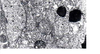 Mitokondriomäärä solussa Mitokondrion proteiinit maksasolussa solun kokonaisproteiinista 30-35 % on mitokondrioissa ja munuaissolussa 20 % hiiren maksa: 8,7x10 10 mitonkondriota/g tuorepaino,
