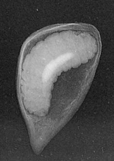 Toukat kuusen siemenissä Kuusen siemensääski Plemeliella abietina Kun siemenen avaa: toukka on oranssinkeltainen Toukka tekee harsopussin