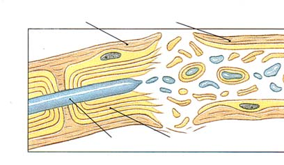 Neurotransmitterin synteesi ja kuljetus Kemiallinen synapsi 2 6. Old membrane components digested in lysosomes Action potential terminal 5.