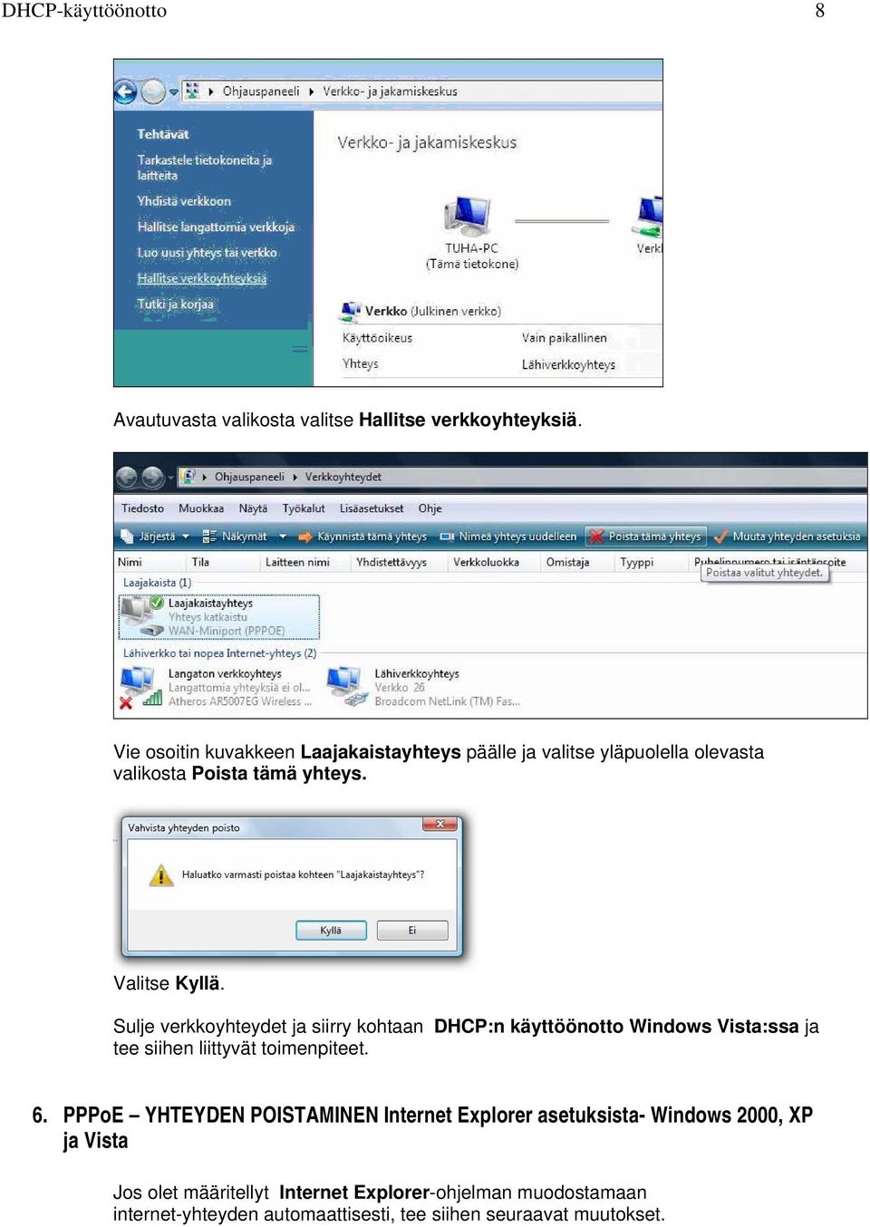 Sulje verkkoyhteydet ja siirry kohtaan DHCP:n käyttöönotto Windows Vista:ssa ja tee siihen liittyvät toimenpiteet. 6.