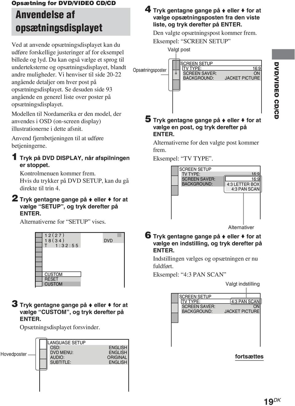 Se desuden side 93 angående en generel liste over poster på opsætningsdisplayet. Modellen til Nordamerika er den model, der anvendes i OSD (on-screen display) illustrationerne i dette afsnit.