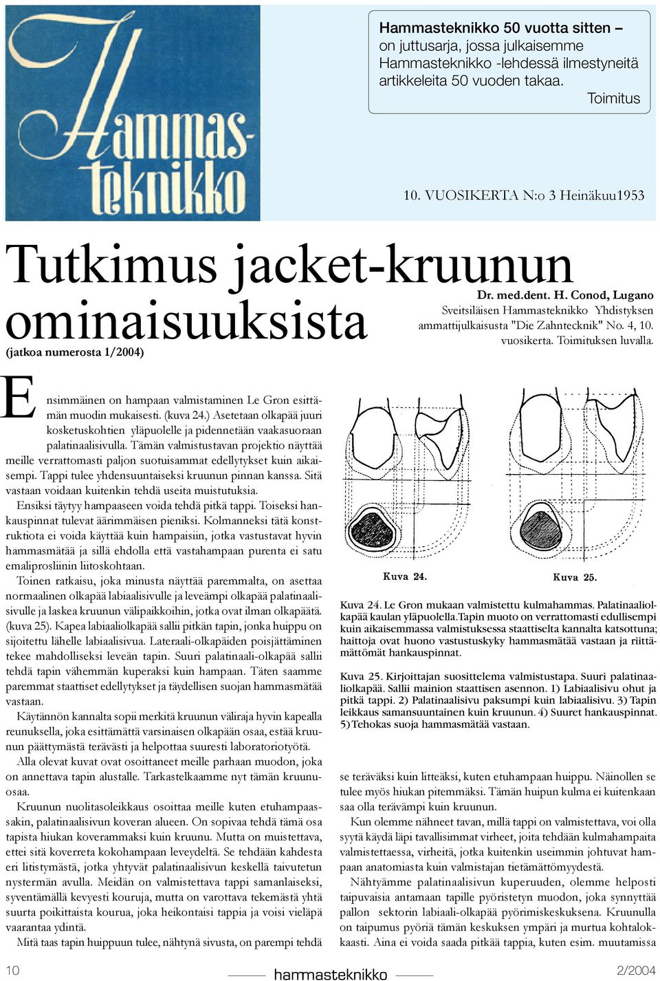4, 10. vuosikerta. Toimituksen luvalla. E nsimmäinen on hampaan valmistaminen Le Gron esittämän muodin mukaisesti. (kuva 24.