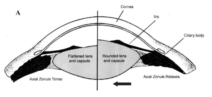 11 Kuvio 7. Akkommodaation aiheuttamat muutokset silmässä. Vasemman puoleisessa kuvassa silmä on lepotilassa ja oikean puoleisessa akkommodaatiotilassa.