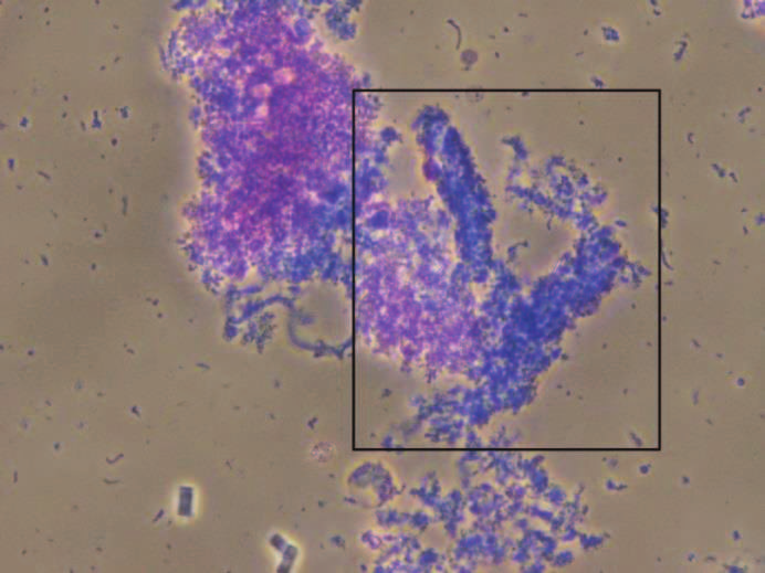 15 (25) KUVA 12A. Hyaliinilieriö 400-kertaisella suurennoksella KUVA 12B.