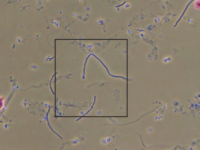 17 (25) kuten Klebsiella- ja Proteus-lajien bakteerit, ovat yleisiä infektion aiheuttajia. (Parpala 2013, 119 120; Lumio 2011.) KUVA 15A. Bakteereita 400-kertaisella suurennoksella KUVA 15B.