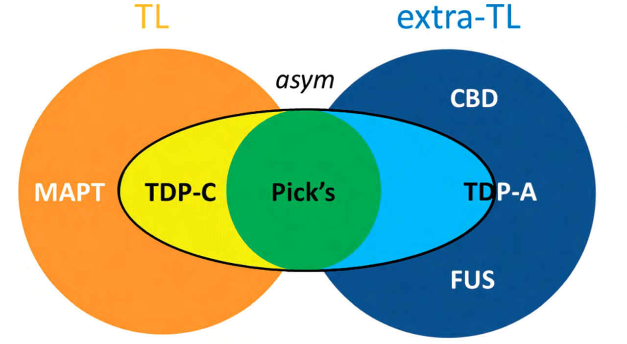Diagrammatic summary of neuroanatomical features associated with pathological diagnosis in this FTLD cohort.