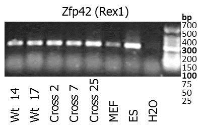 32 Kuvio 16. PCR-tulos Zfp42