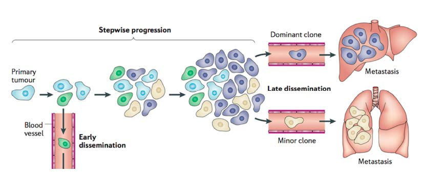 Syöpä muuntuu ajan myötä Primary and metastasis clonal