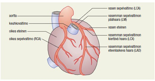 10 3 SEPELVALTIMOTAUTI Sepelvaltimotauti on ateroskleroosin eli valtimonkovettumistaudin ilmentymä sydäntä ravitsevissa sepelvaltimoissa.