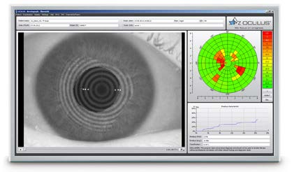 Kuivasilmäisyyteen löytyy laitteistoja, joilla voidaan tehdä hyvinkin kattava Kuivan Silmän analyysi.