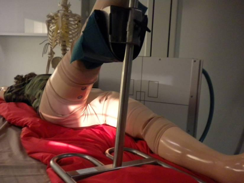 LONKKA AXIAALI Horisontaalisätein KUVAUSTEKNIIKKA Kuvausteline Thorax Kuvalevy 24 x 30 Hila Etäisyys Kyllä 115 cm Fokus Iso kv 100 mas 25 ASETTELU Maaten, horisontaalisätein Kasetti thorax-telineessä